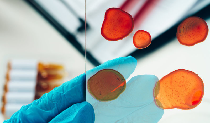 Mikroskopische Analyse von Blutproben zur Untersuchung der Zusammenhänge zwischen der Darmflora und Diabetes Typ 2, mit Fokus auf die Verbesserung des Tages-Nacht-Rhythmus der Darmflora.